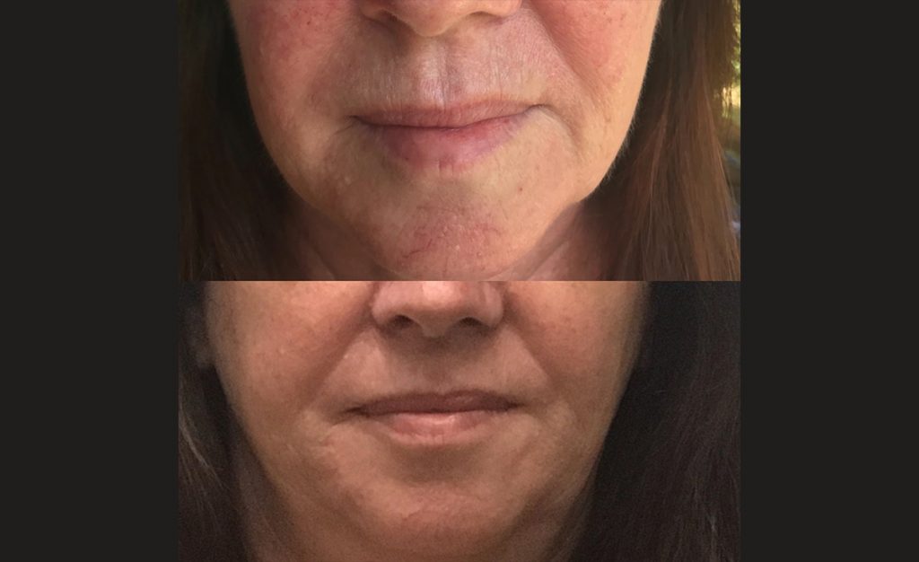 Case Study Clarity, Clear & Calm