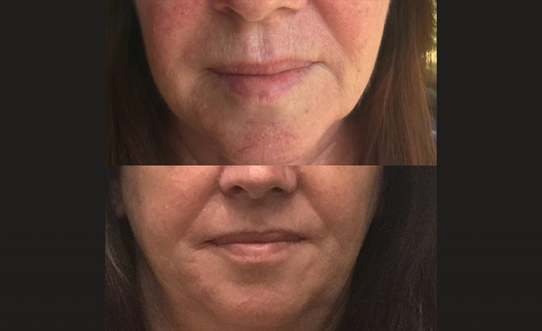 Case Study Clarity, Clear & Calm